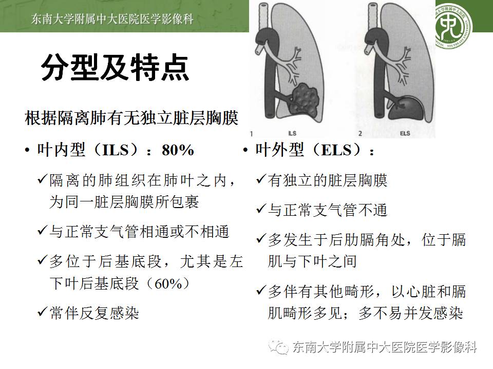 【病例】肺隔离症1例CT影像表现