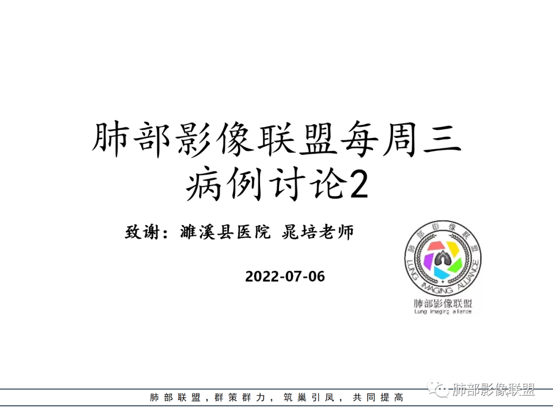 【病例】硬化性肺泡细胞瘤PSP一例CT-1 【病例】硬化性肺泡细胞瘤PSP一例CT-1