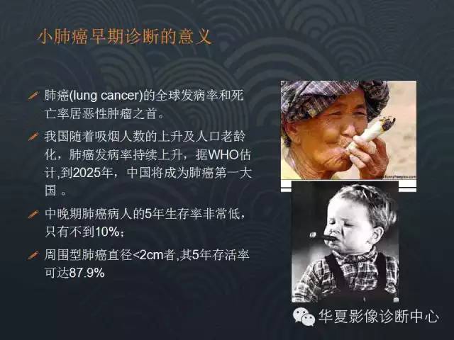 【PPT】小肺癌的影像表现及鉴别诊断