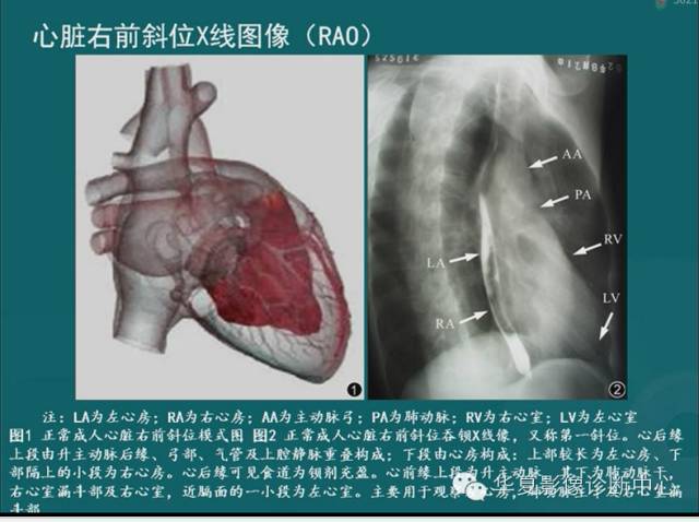 【PPT】MRI原理及脉冲序列的部分问题