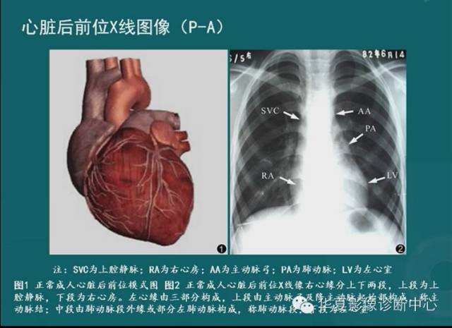 【PPT】MRI原理及脉冲序列的部分问题