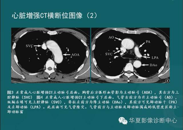【PPT】MRI原理及脉冲序列的部分问题