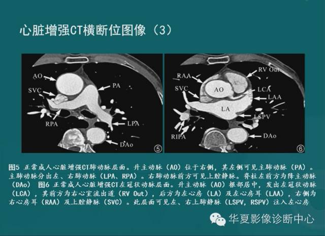 【PPT】MRI原理及脉冲序列的部分问题