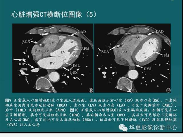 【PPT】MRI原理及脉冲序列的部分问题