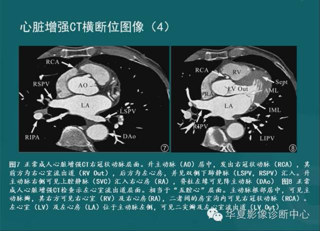 【PPT】MRI原理及脉冲序列的部分问题
