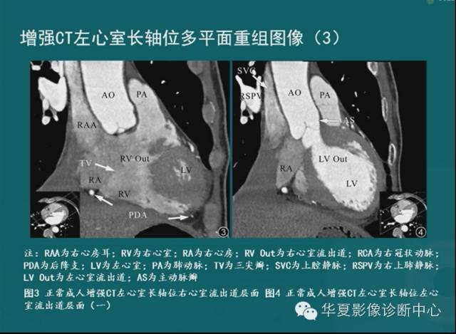【PPT】MRI原理及脉冲序列的部分问题