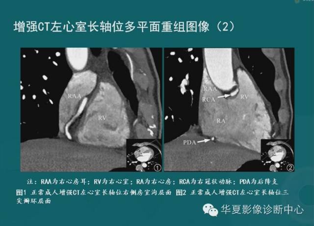 【PPT】MRI原理及脉冲序列的部分问题