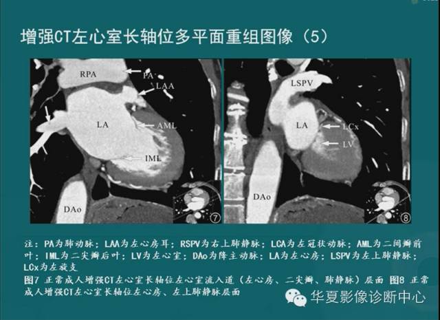 【PPT】MRI原理及脉冲序列的部分问题