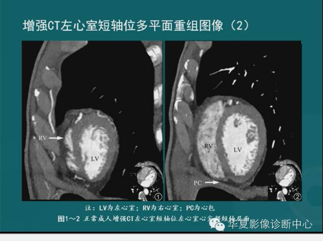 【PPT】MRI原理及脉冲序列的部分问题