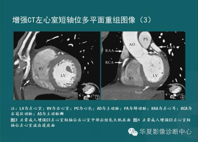 【PPT】MRI原理及脉冲序列的部分问题
