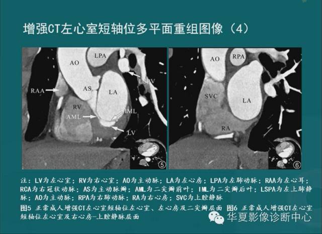 【PPT】MRI原理及脉冲序列的部分问题