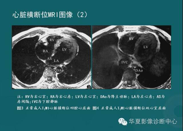【PPT】MRI原理及脉冲序列的部分问题
