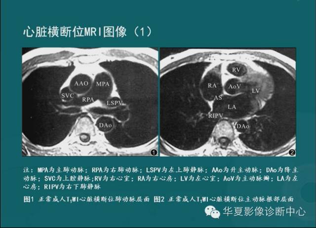 【PPT】MRI原理及脉冲序列的部分问题