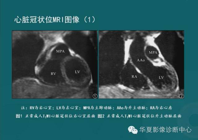 【PPT】MRI原理及脉冲序列的部分问题