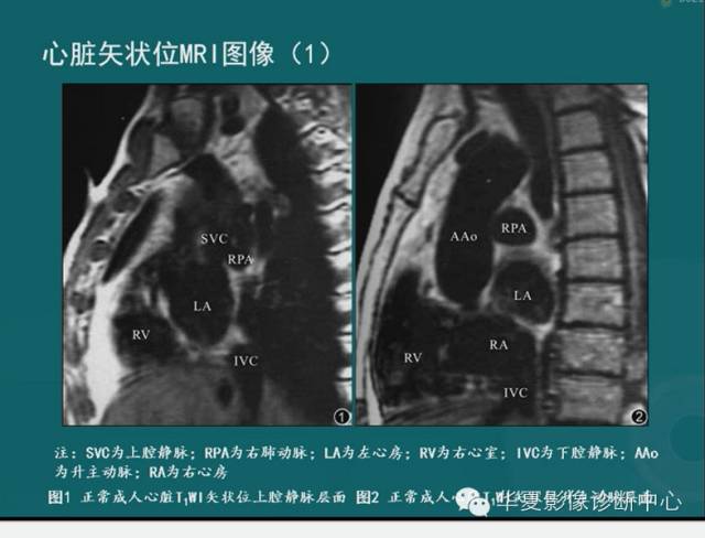 【PPT】MRI原理及脉冲序列的部分问题