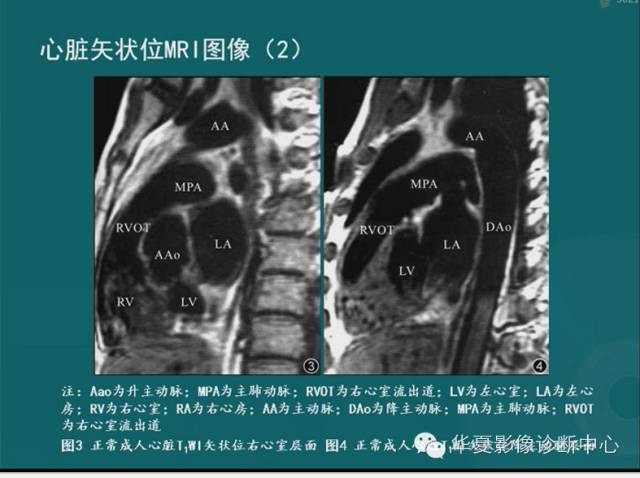 【PPT】MRI原理及脉冲序列的部分问题