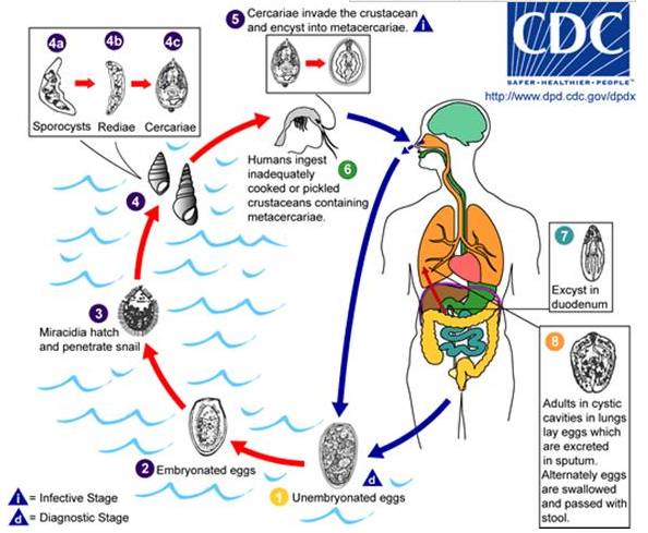 【病例】肺吸虫囊肿1例CT影像表现 【病例】肺吸虫囊肿1例CT影像表现