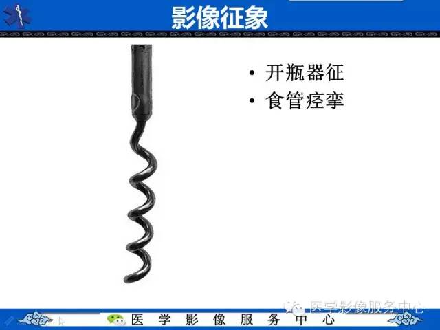 【影像征象】开瓶器征——食管痉挛