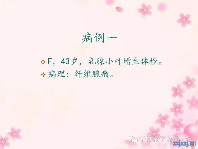【PPT】乳腺MRI对直径1厘米左右小结节灶良恶性的界定作用