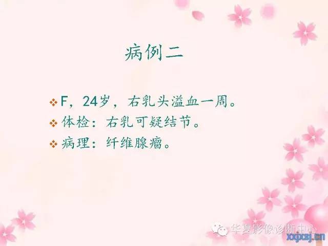 【PPT】乳腺MRI对直径1厘米左右小结节灶良恶性的界定作用