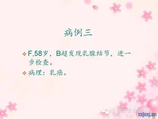 【PPT】乳腺MRI对直径1厘米左右小结节灶良恶性的界定作用