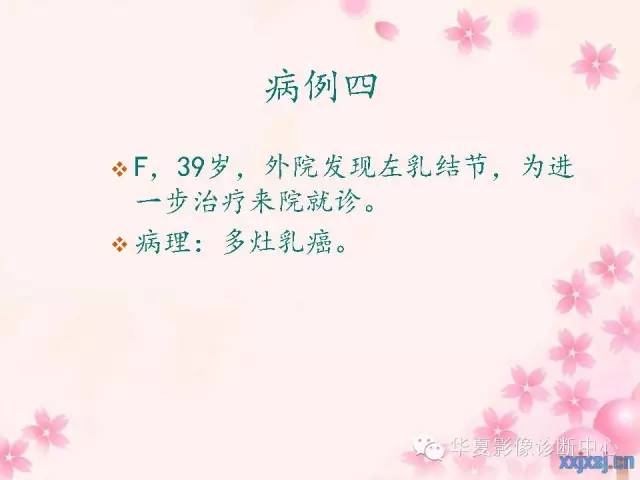 【PPT】乳腺MRI对直径1厘米左右小结节灶良恶性的界定作用