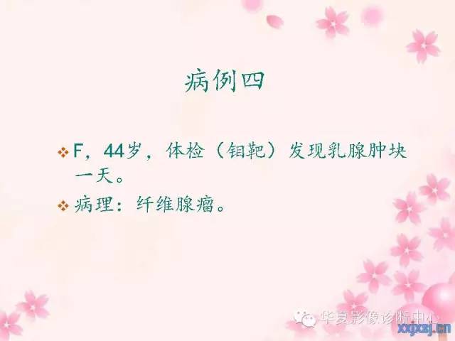 【PPT】乳腺MRI对直径1厘米左右小结节灶良恶性的界定作用