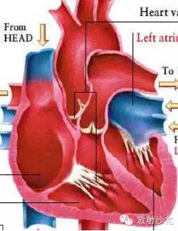 心脏常见疾病的X线诊断