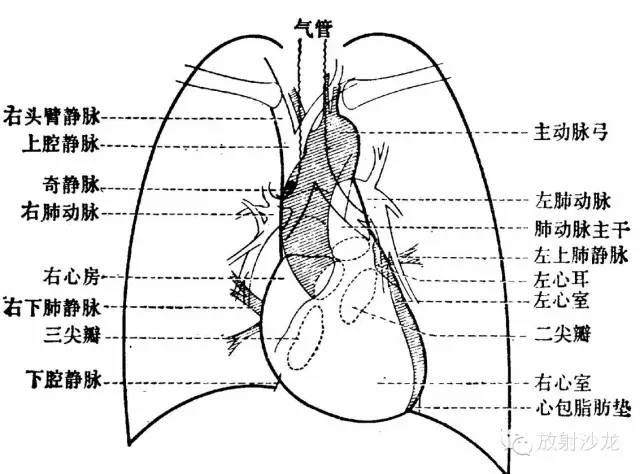 心脏常见疾病的X线诊断