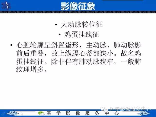 【影像征象】鸡蛋挂线征——大动脉转位征