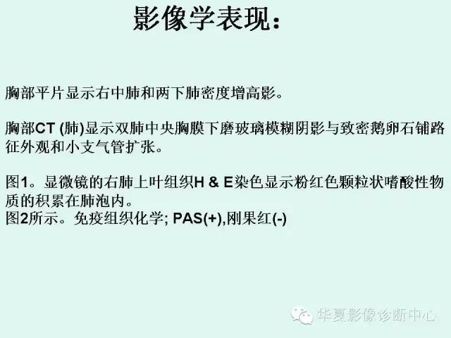 【病例】肺泡蛋白沉积症1例CT影像表现