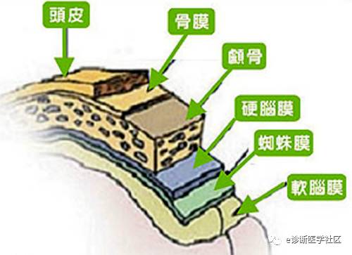 15种亚型脑膜瘤影像表现及诊断要点