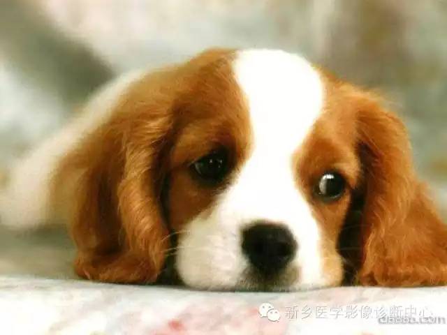 【病例】木村病1例CT影像表现与鉴别