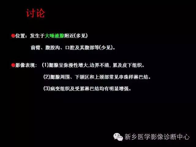 【病例】木村病1例CT影像表现与鉴别