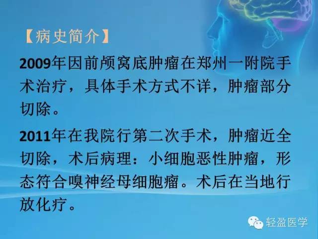 【病例】颅内肿瘤，脑内？脑外？