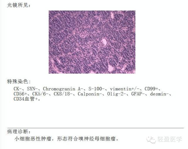 【病例】颅内肿瘤，脑内？脑外？