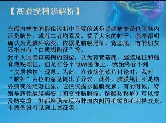 【病例】颅内肿瘤，脑内？脑外？