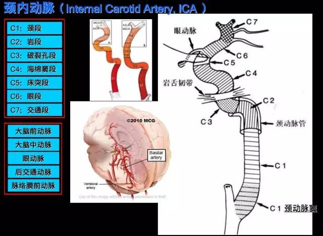 颈内-脑动脉分段、分支