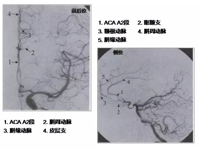 颈内-脑动脉分段、分支
