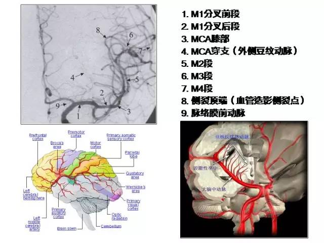 颈内-脑动脉分段、分支
