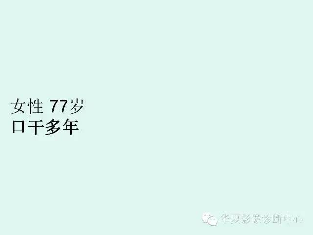 肺淀粉样变性1例CT影像表现