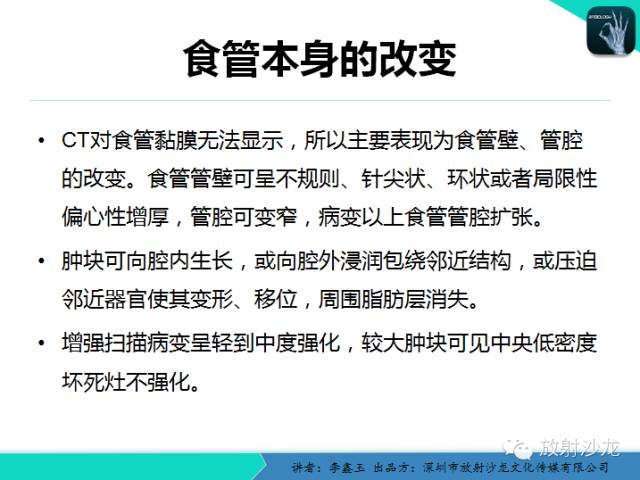 【原创】CT在食管癌诊疗中的应用