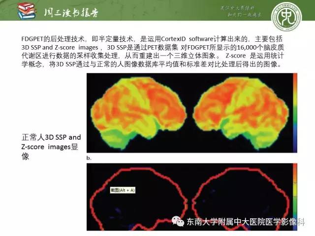 【PPT】帕金森综合征的结构与功能成像