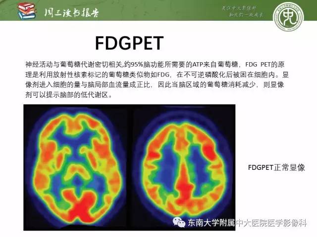 【PPT】帕金森综合征的结构与功能成像