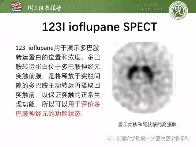 【PPT】帕金森综合征的结构与功能成像