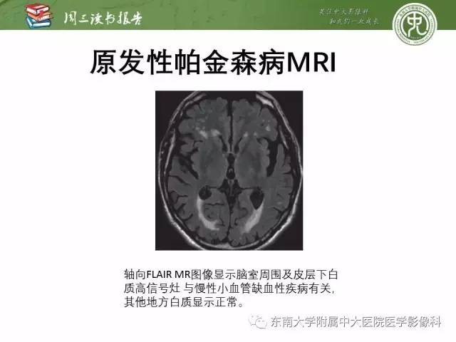【PPT】帕金森综合征的结构与功能成像
