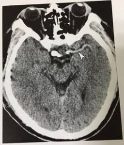 这些片子里的结构，你都认识吗？