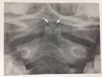 这些片子里的结构，你都认识吗？