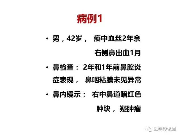 【PPT】鼻腔鼻窦肿瘤与肿瘤样病变的影像学诊断分析思路