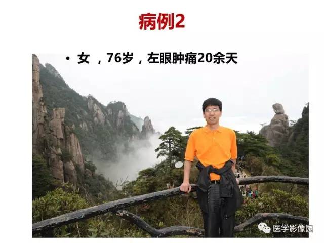 【PPT】鼻腔鼻窦肿瘤与肿瘤样病变的影像学诊断分析思路